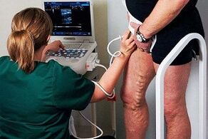 Diagnosztikai lehetőségek a lábak varikózusának számára